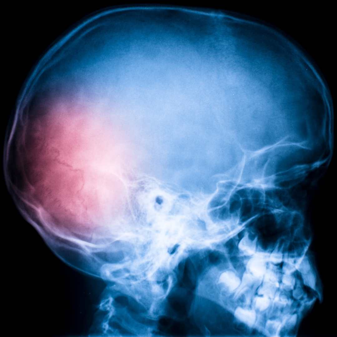 brain stress response image