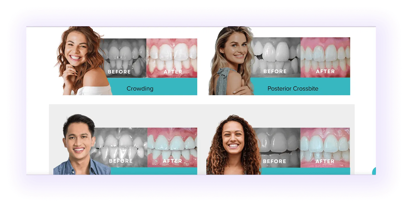 before-and-after treatment photos block on an orthodontic clinic website