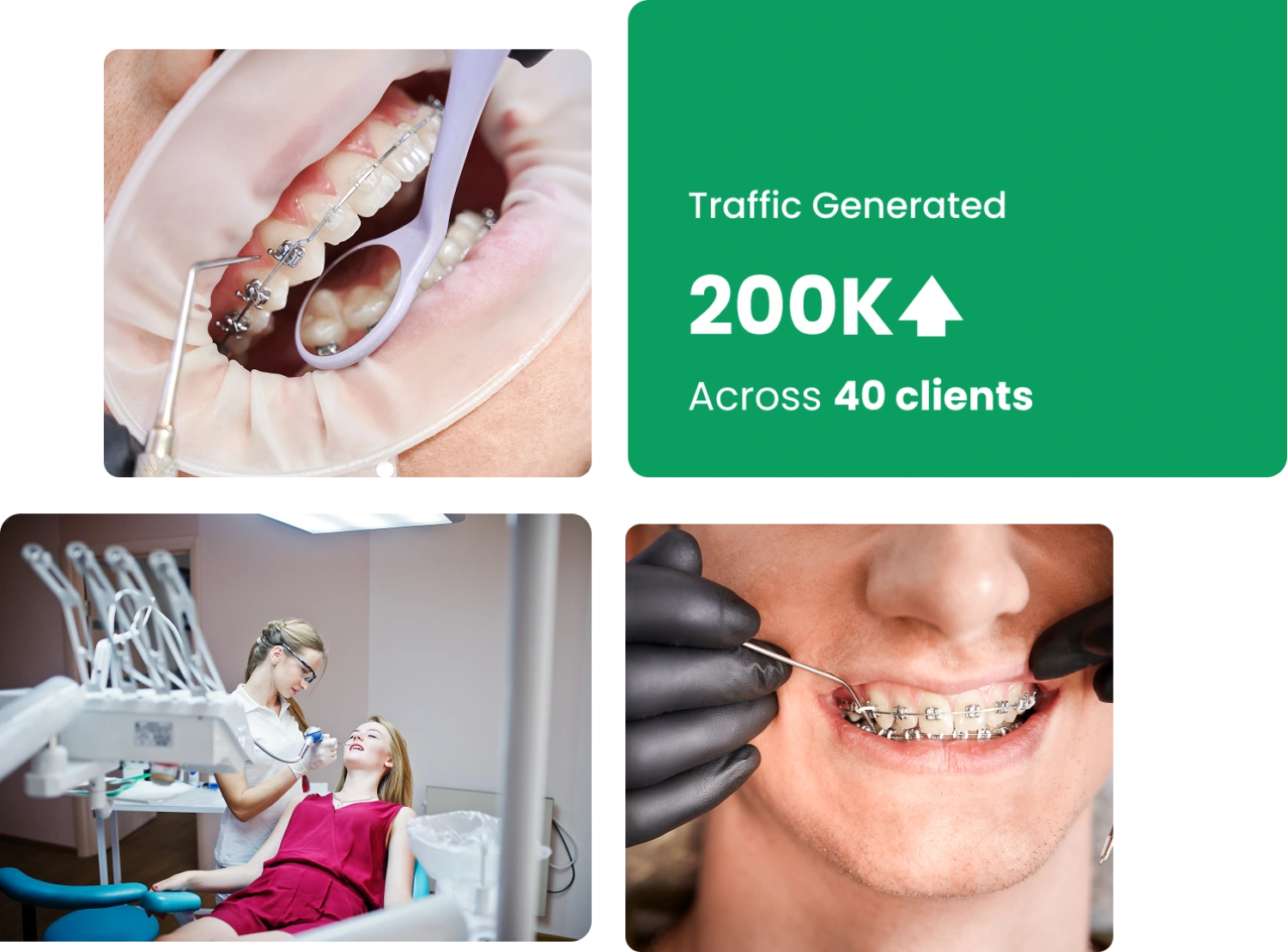SEO for Orthodontists