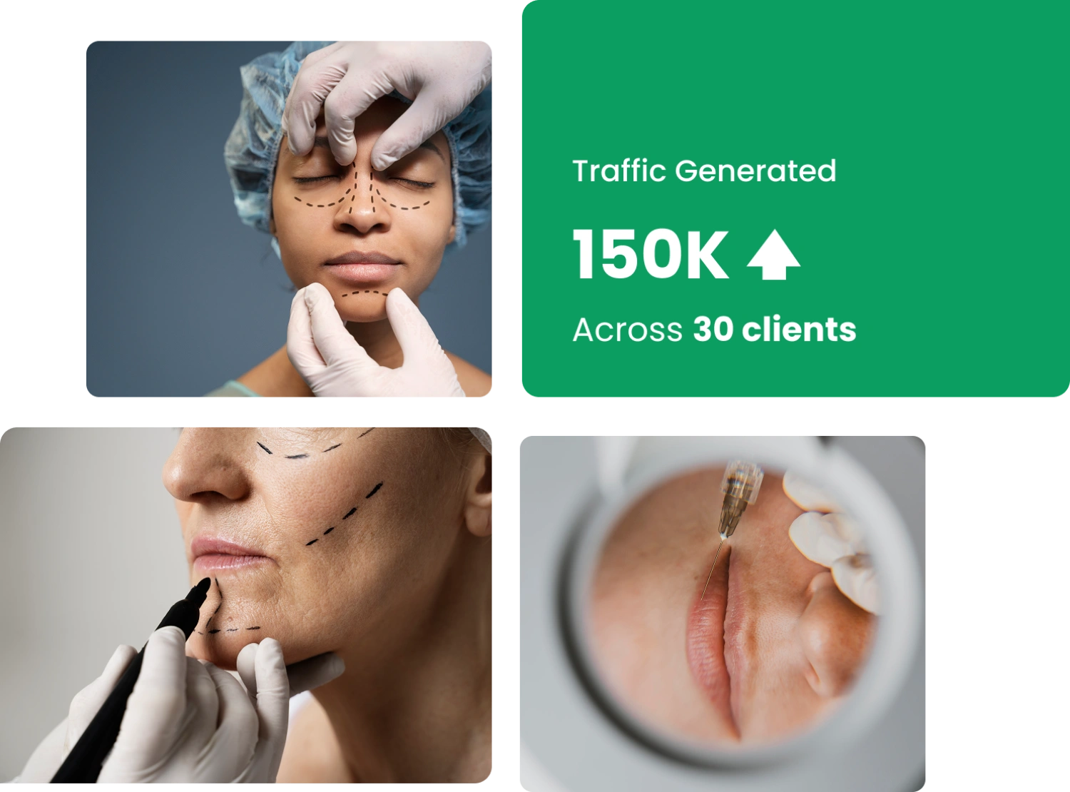 SEO for Plastic Surgeons