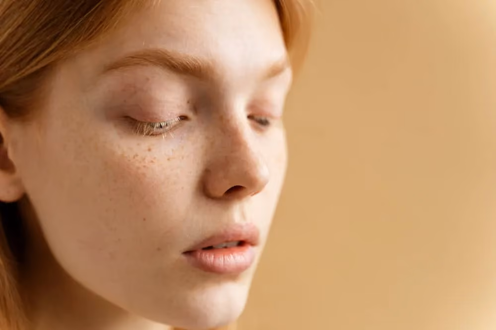 Image of a woman wih mild skin pigmentation on face