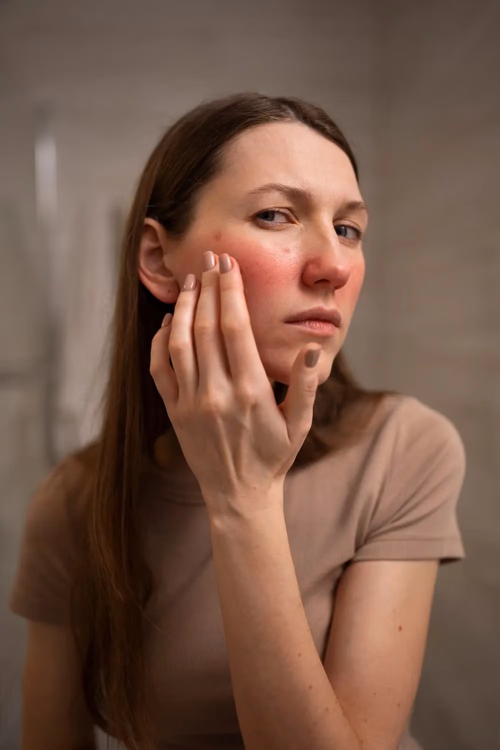 Person with facial redness on the cheek consistent with rosacea