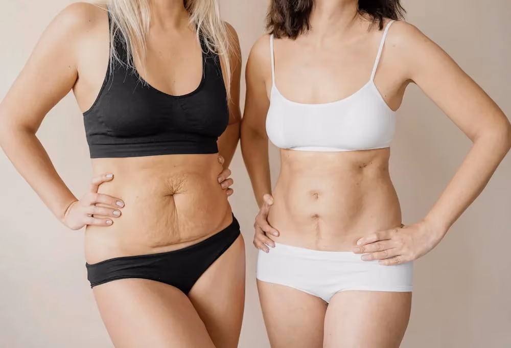Image of women displaying their body confidently