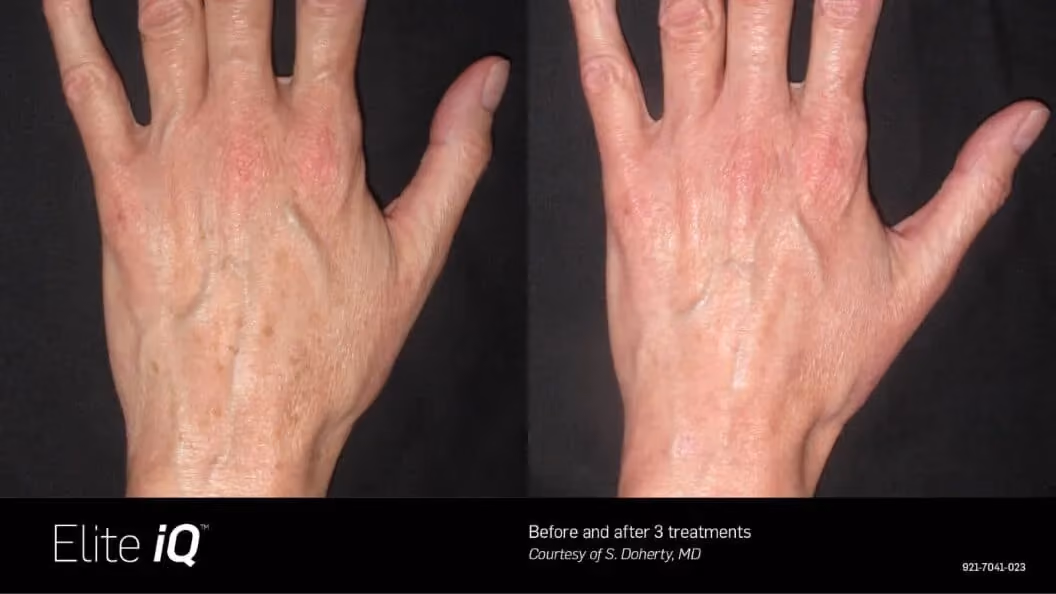 Before and after image displaying client hand
