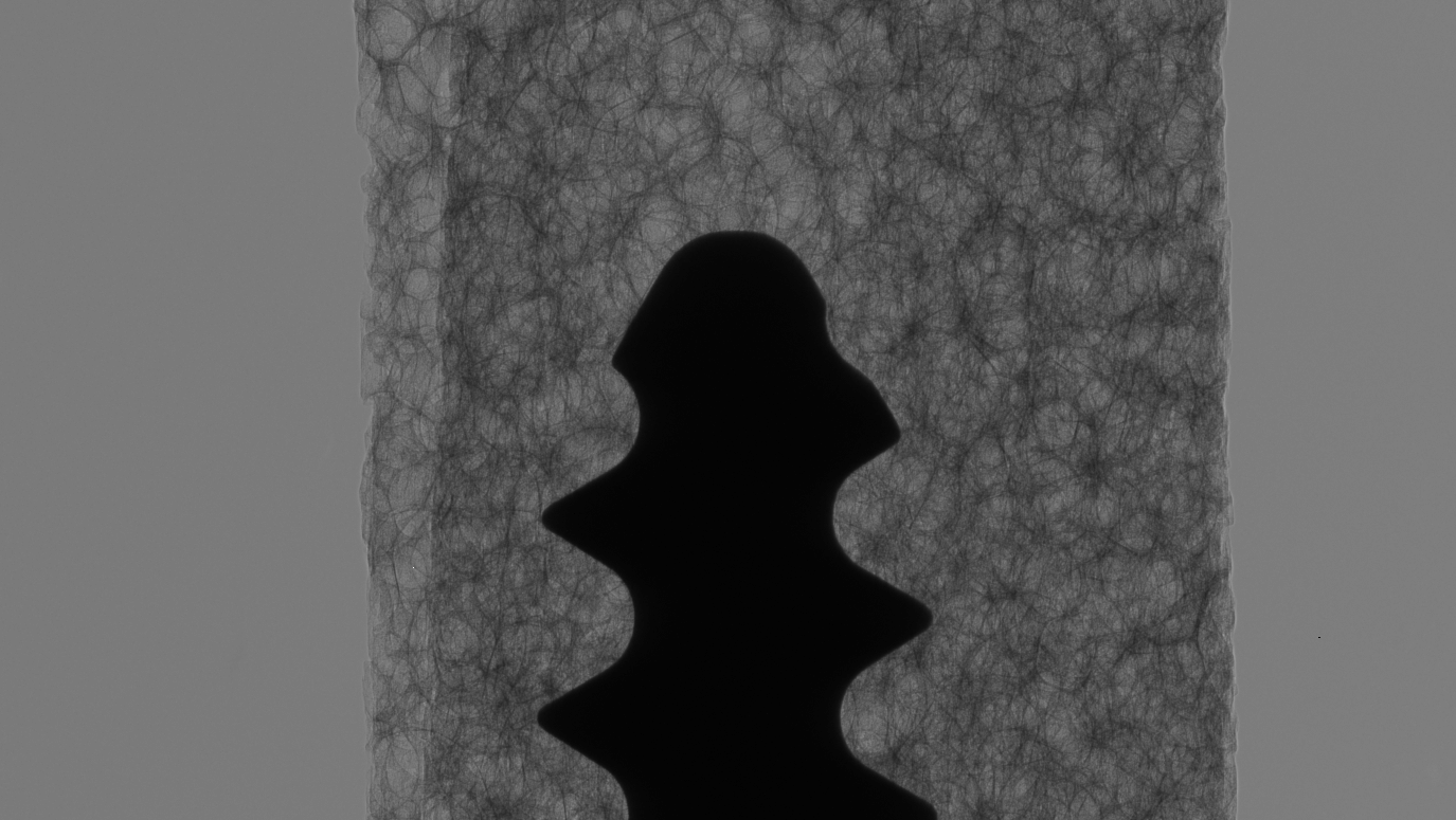 Phase-contrast image of a bone