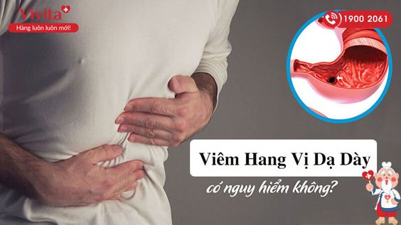 [HOT] Viêm Hạng Vị Dạ Dày Có Nguy Hiểm Không? Dấu Hiệu Và Cách Trị