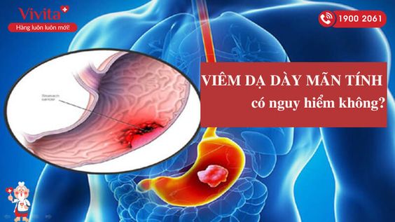 Viêm Dạ Dày Mãn Tính Có Nguy Hiểm Không? Tìm Hiểu Ngay Nhé?