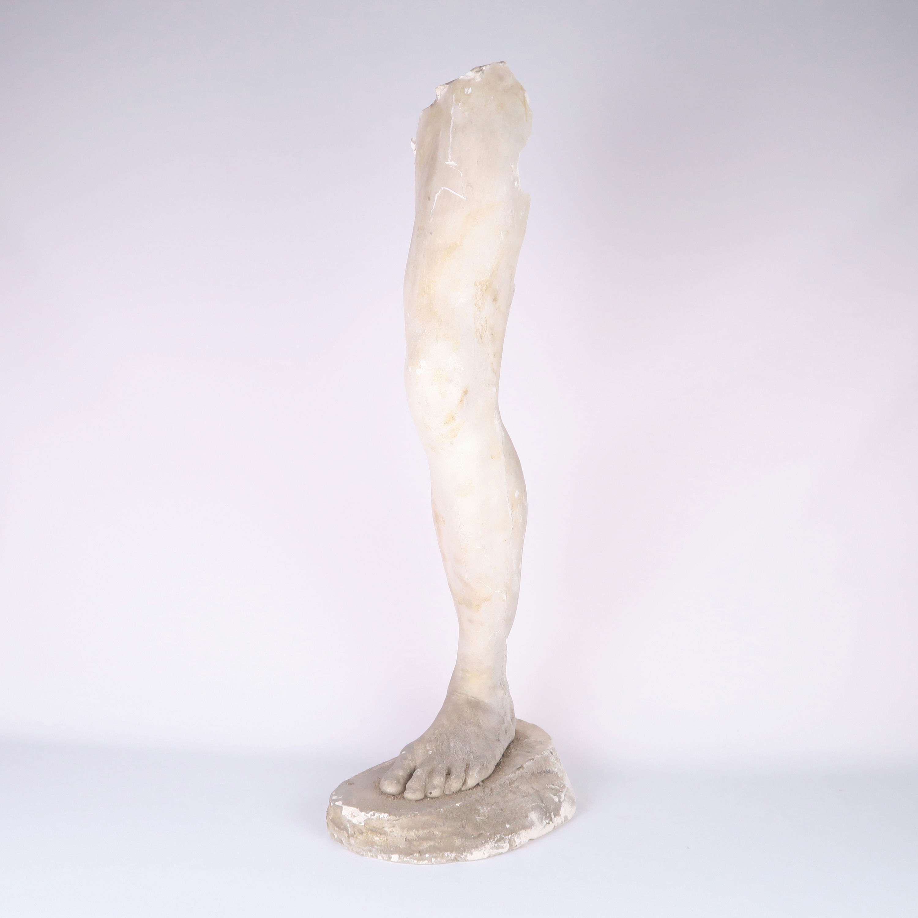 jambe gauche en plâtre 