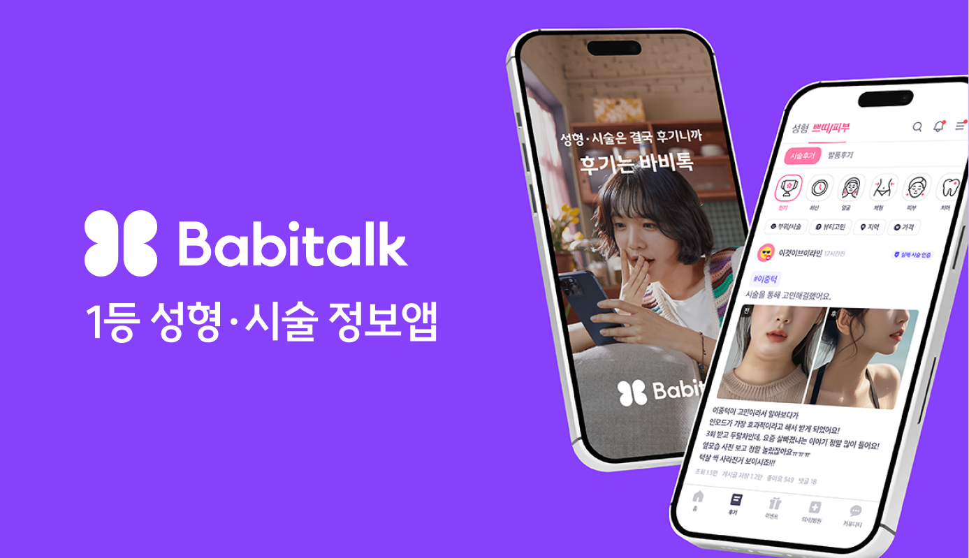 바비톡 배너