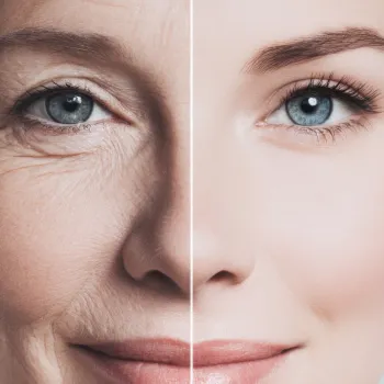 Vorher/Nachher Bild Stammzellen Therapie