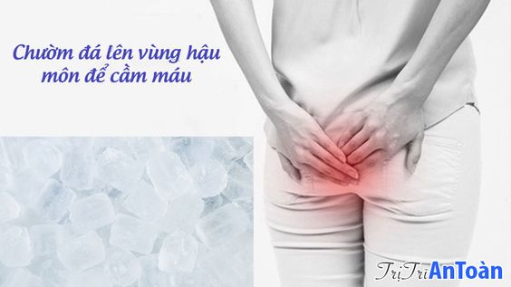 Bị Trĩ Ra Máu? TOP 4 Bài Thuốc Cầm Máu Bệnh Trĩ Tốt Nhất Từ Dân Gian