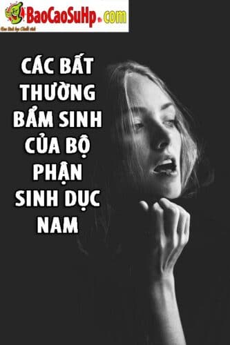 cac bam sinh bat thuong cua bo phan sinh duc nam 333x500 - Các bất thường bẩm sinh của bộ phận sinh dục nam