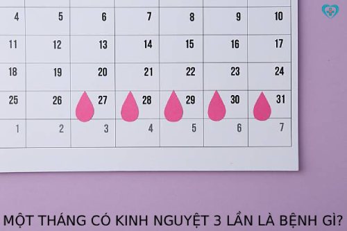 Một tháng có kinh nguyệt 3 lần
