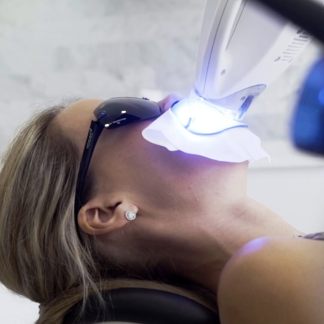 Young female patient receiving Philips Zoom! teeth whitening treatment at le tooth