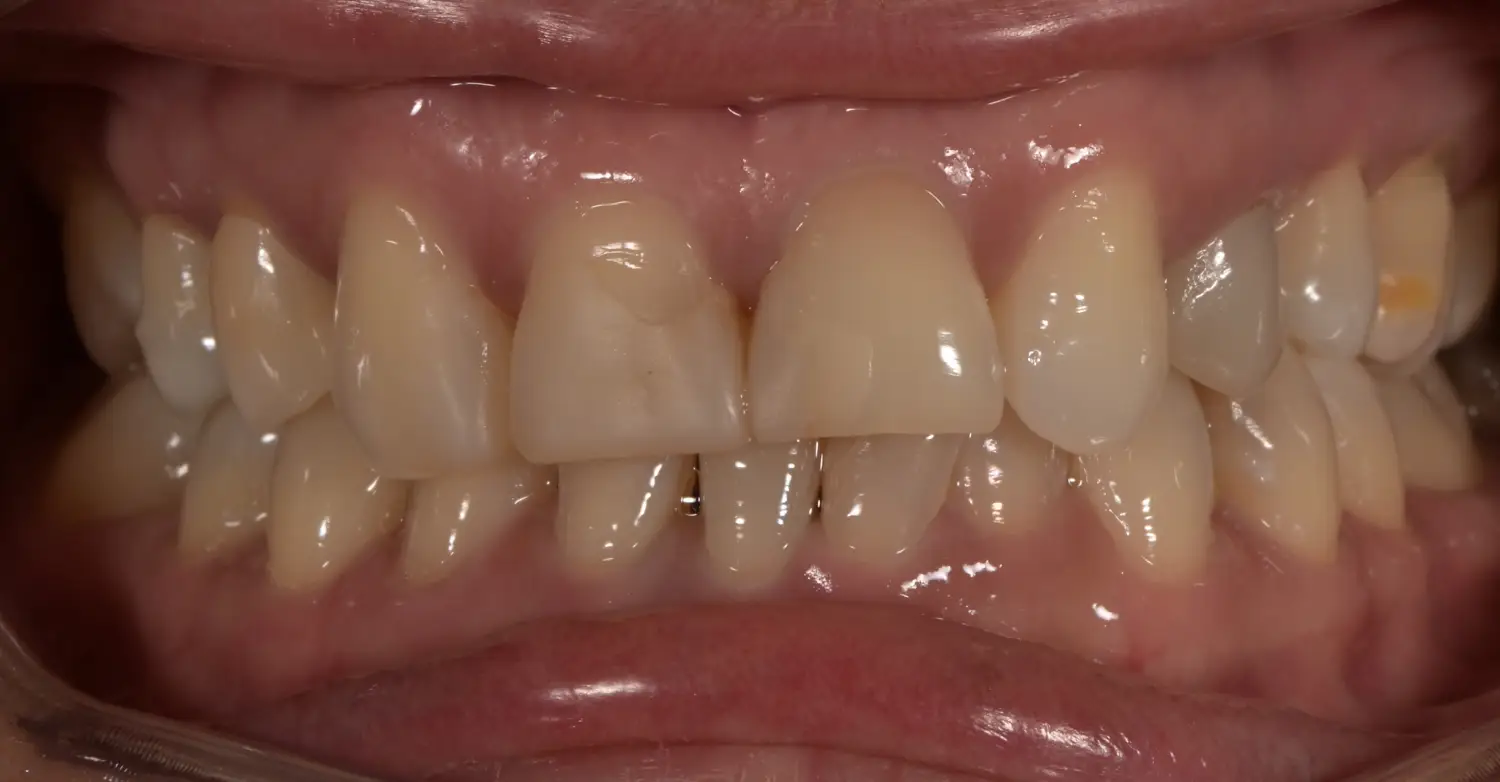 before and after treatment