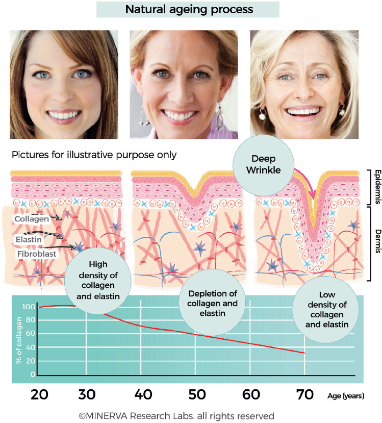 Visual representation of skin aging stages, depicting the progression of wrinkles, sagging, and discoloration.