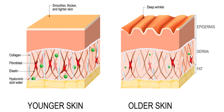 diagram showing structural differences between young skin and aging skin