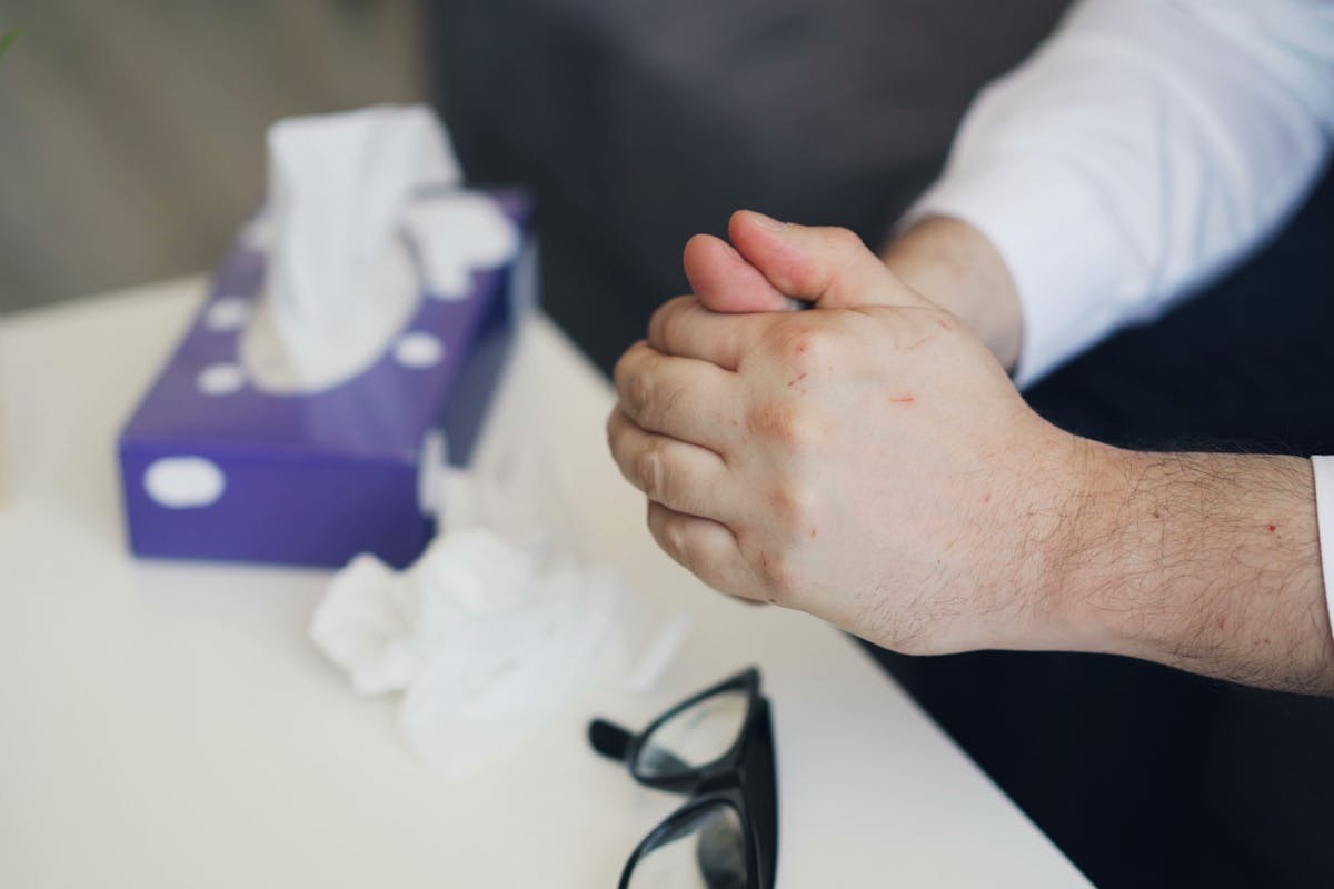man seated with his hands folded in a therapist office, while a tissue box and crumpled tissues sit on the table in front of him