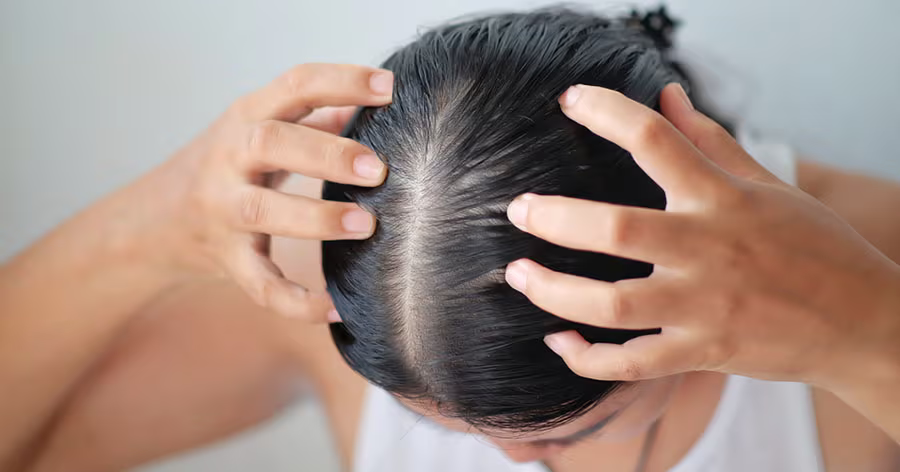 woman checking her part to monitor hair loss