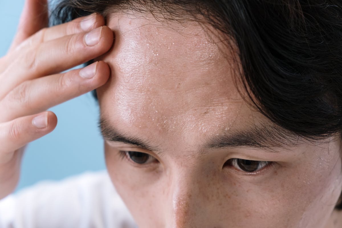 man examining his scalp health after noticing dandruff flakes