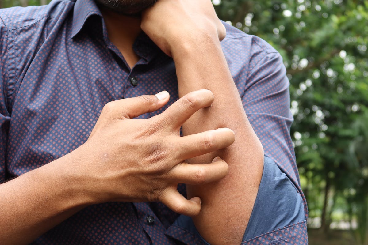 man with the sleeves of his button down shirt rolled up to scratch his uncomfortable skin on his arms