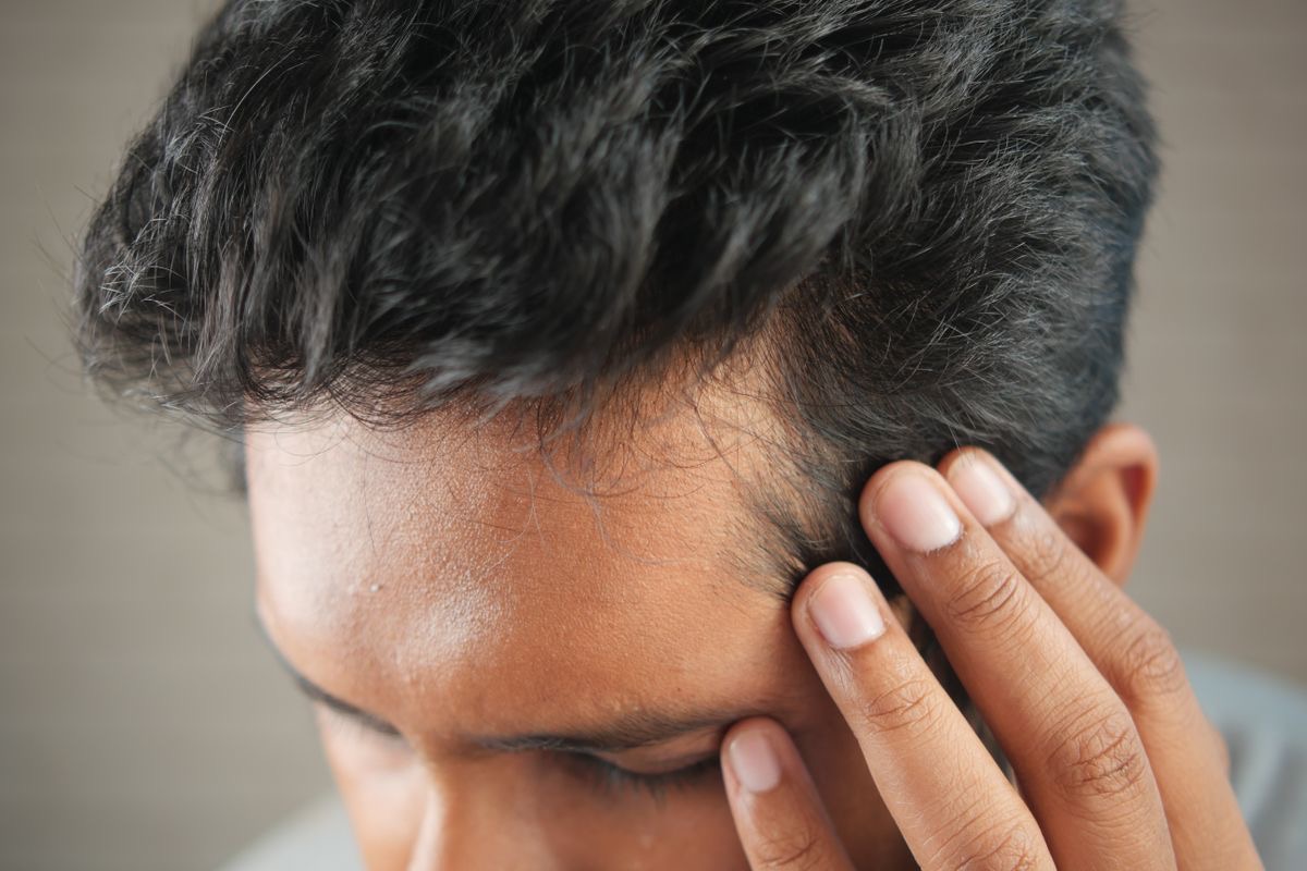 man with hair thinning around his temples