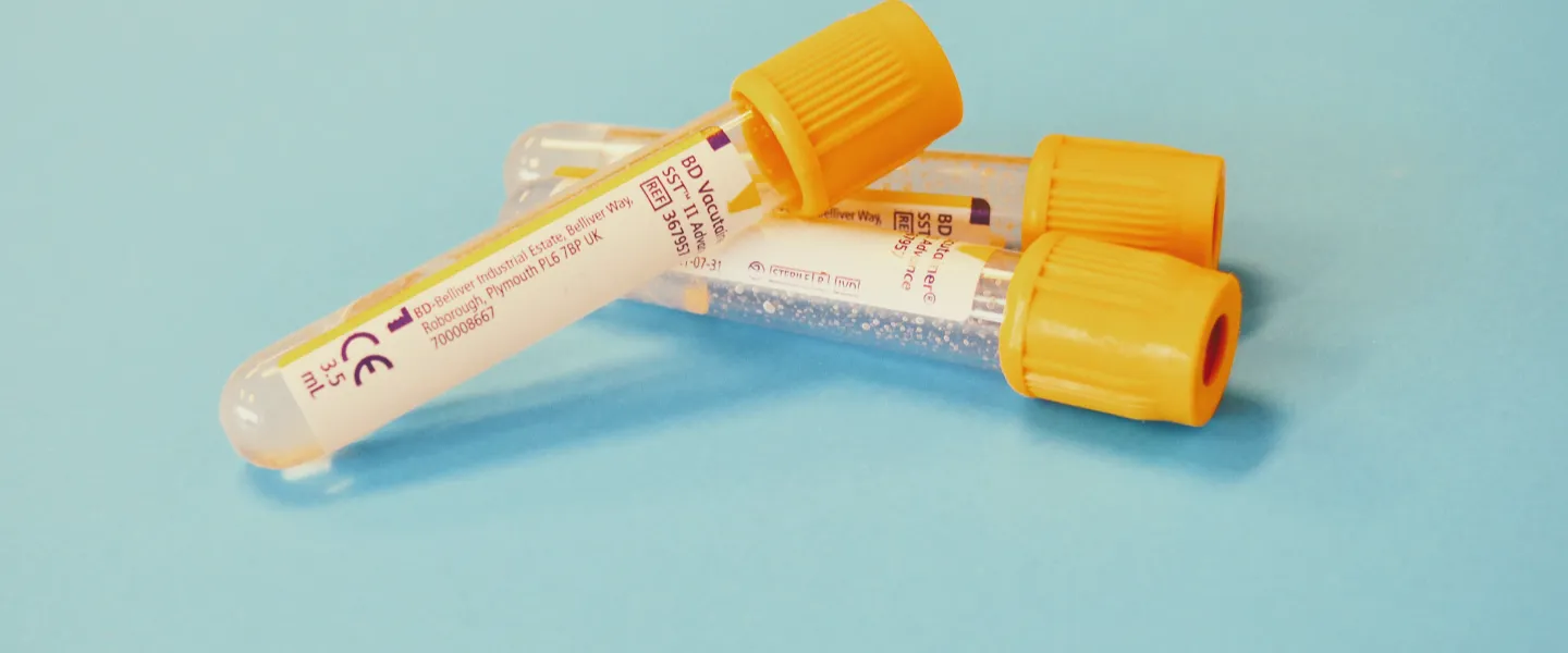 Frasco con tubos de ensayo y recipiente para hacer pruebas químicas.