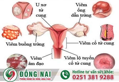 D:\Bai SEO\phong-kham-phu-khoa-uy-tin-o-dong-nai-1 (2).jpg