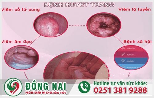 D:\Bai SEO\benh-phu-khoa-huyet-trang.jpg