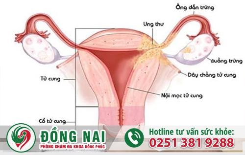 D:\Bai SEO\benh-phu-khoa-va-dau-hieu-2.jpg