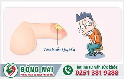 Bệnh viêm bao quy đầu và cách điều trị hiệu quả