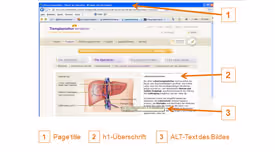 Redaktionelle Suchmaschinenoptimierung (on-page SEO): Der Grundstein für das gute Google-Ranking Ihrer Healthcare-Website!