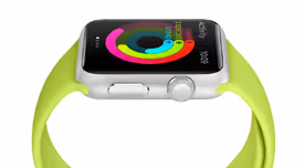 Meine Woche mit der Apple Watch