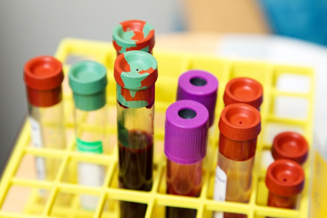 capped test tubes in container