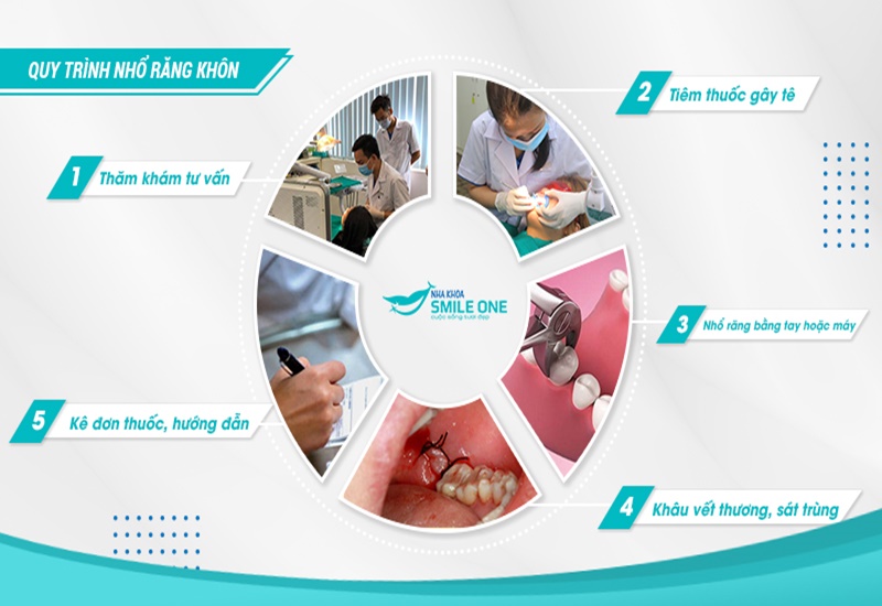 nhakhoasmileone-nho-rang-khon-05