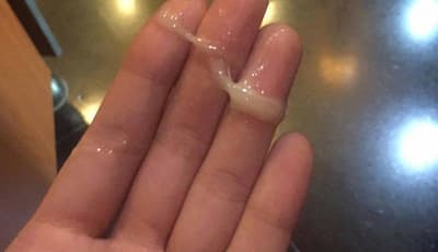 Ra nhiều khí hư có màu trắng đục