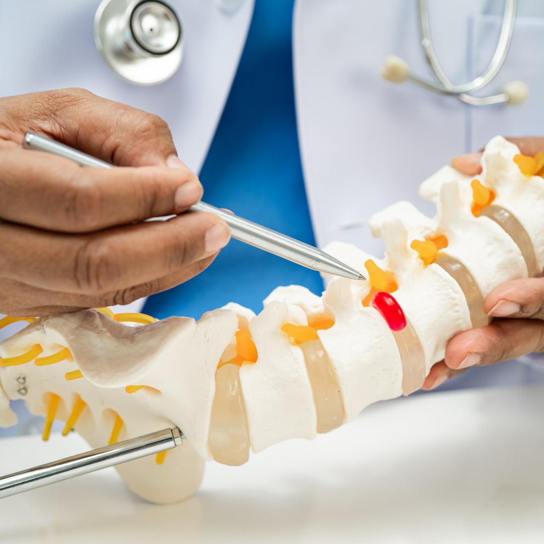 Η Τεχνική UBE (Unilateral Biportal Endoscopy): Μία Σύγχρονη Ελάχιστα Επεμβατική Προσέγγιση για τη Χειρουργική Αντιμετώπιση της Δισκοκήλης