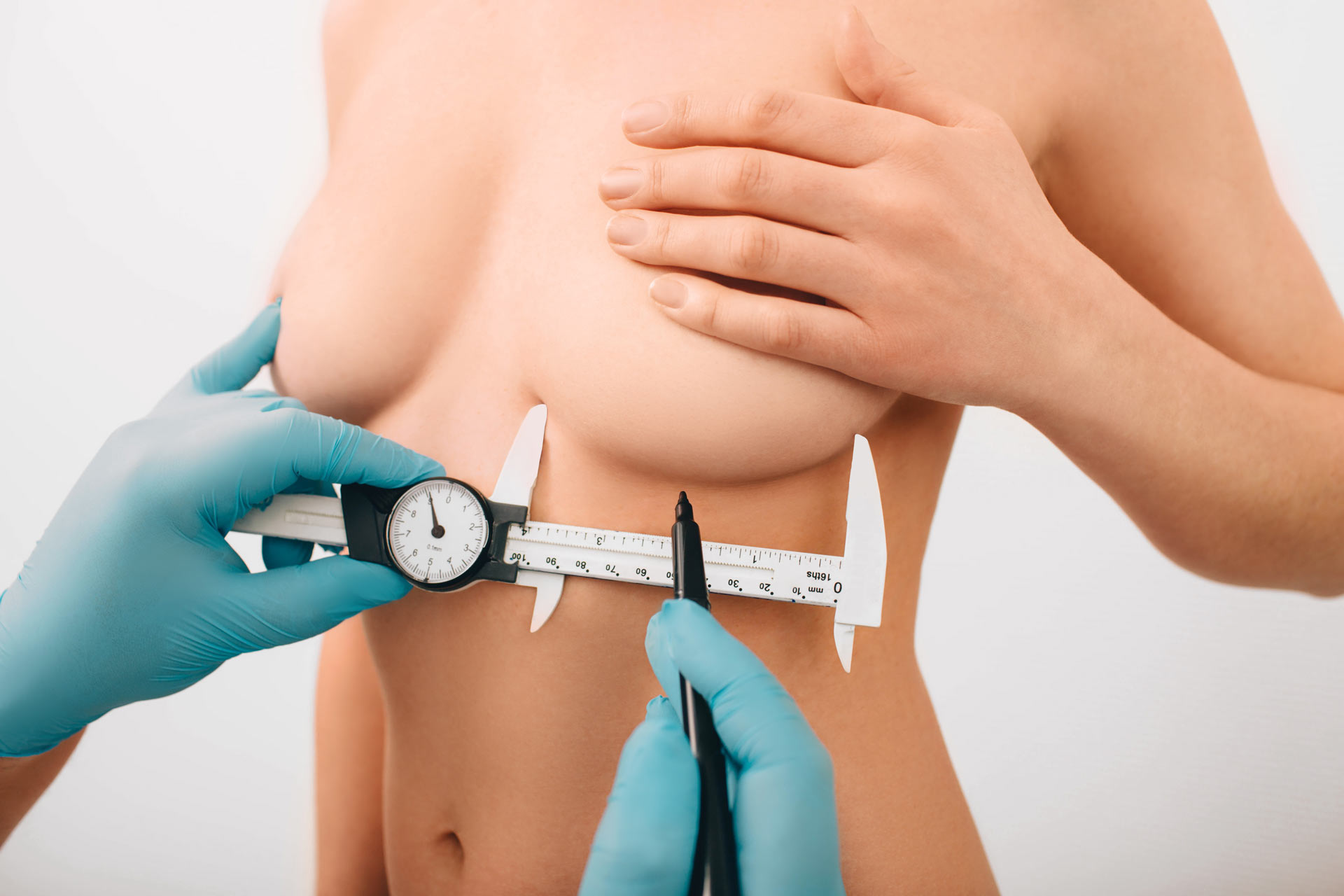 cirujana plástica midiendo tamaño de senos para mamoplastia de aumento