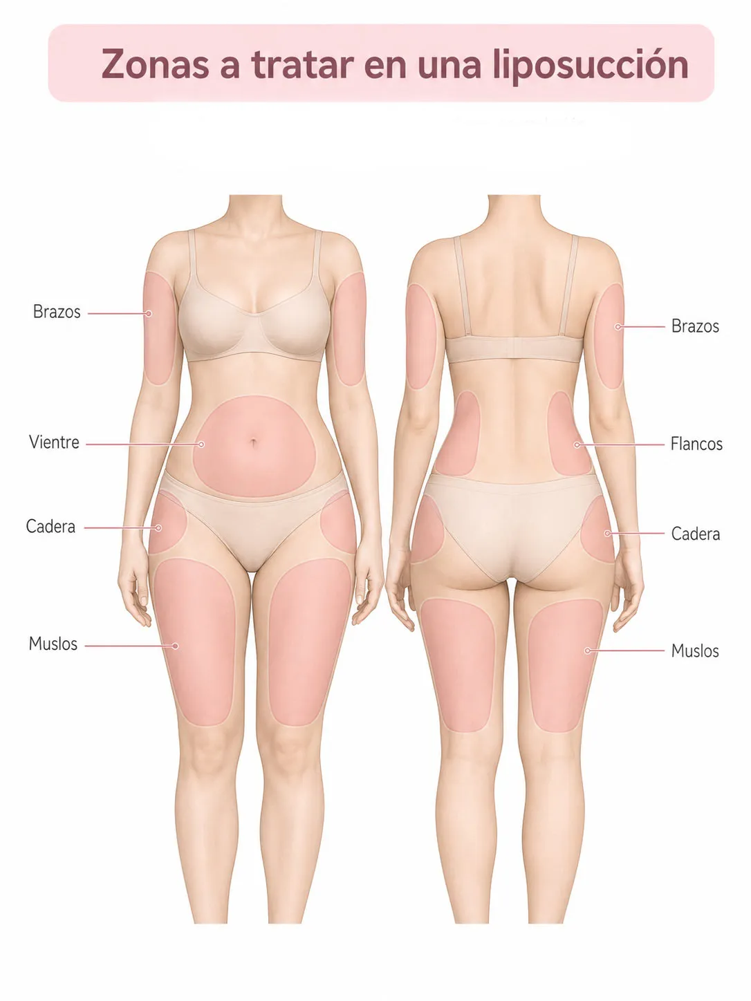 Types of Breast Implants