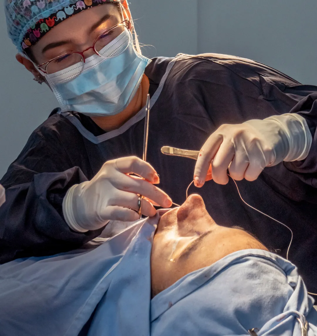 Rinoplastia ultrasonica por la Dra. Adriana Ruiz