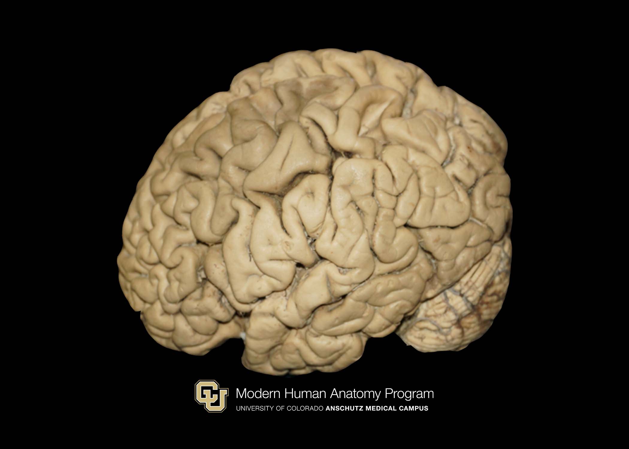 Whole Brain