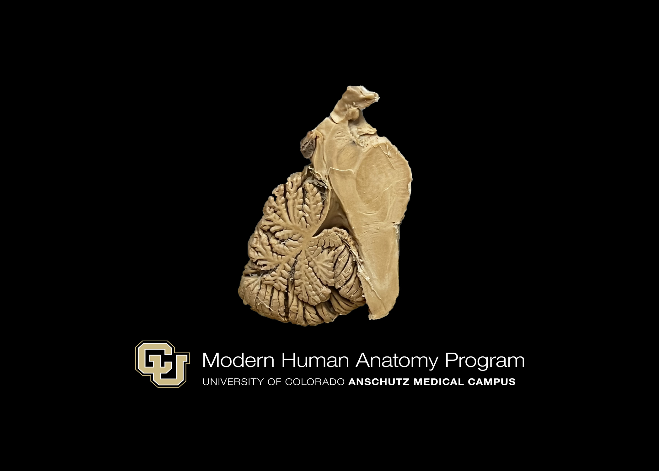 Mid-Sagittal Section of Cerebellum and Brainste,