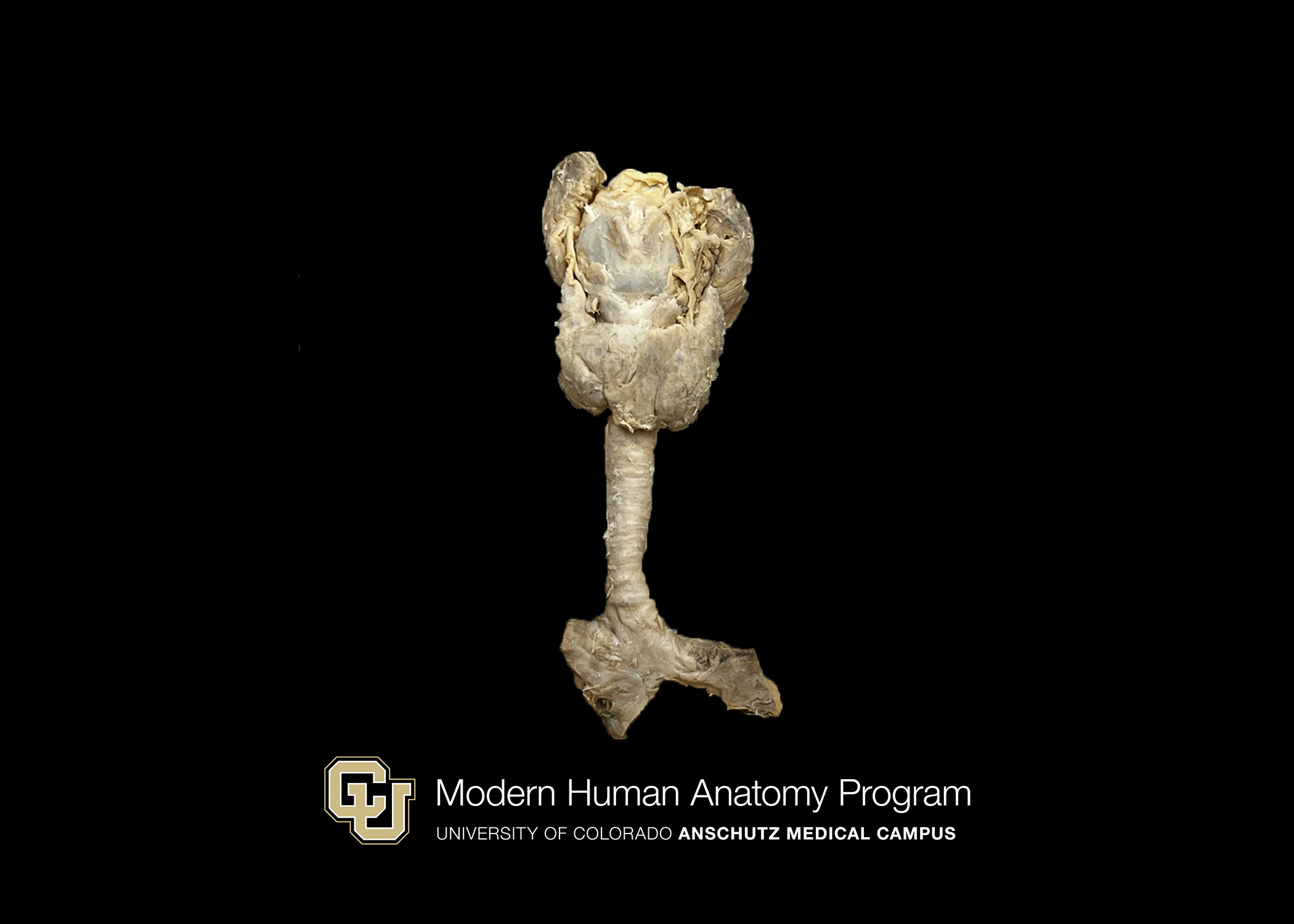 Larynx with thyroid gland and trachea