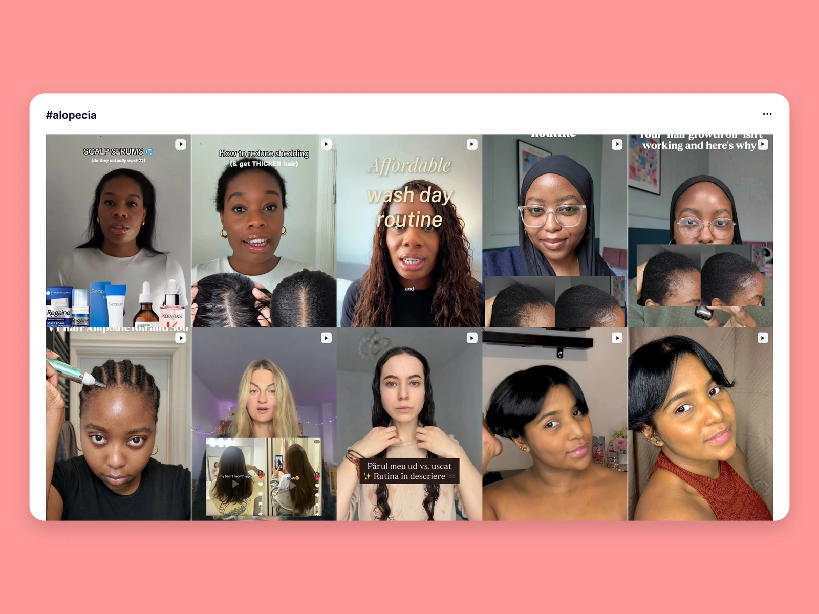 Instagram hashtag results for alopecia content