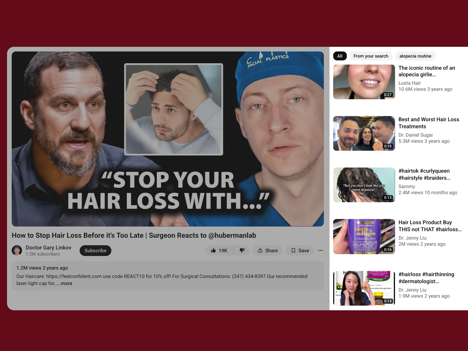 YouTube recommended videos beside a alopecia video