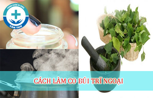 Cách làm co búi trĩ ngoại theo phương pháp dân gian