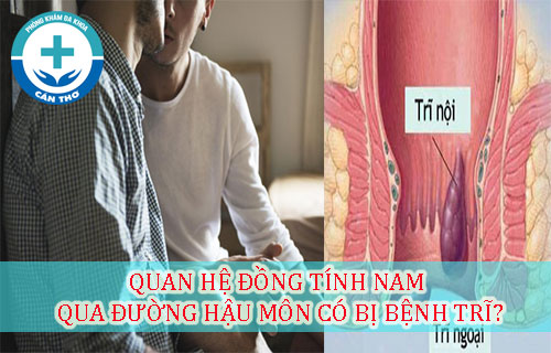 quan hệ đồng tính nam qua đường hậu môn có bị bệnh trĩ