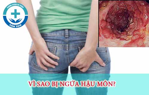 vi-sao-bi-dau-ngua-hau-mon