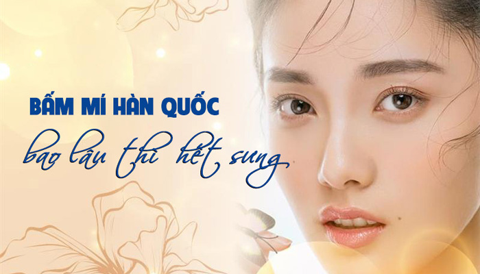 Bấm mí mắt bao lâu hết sưng?