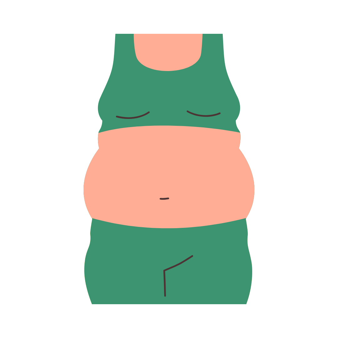 Illustratie van hardnekkig vet of vochtophoping rond de buik en taille die niet weggaat ondanks gezonde gewoontes.